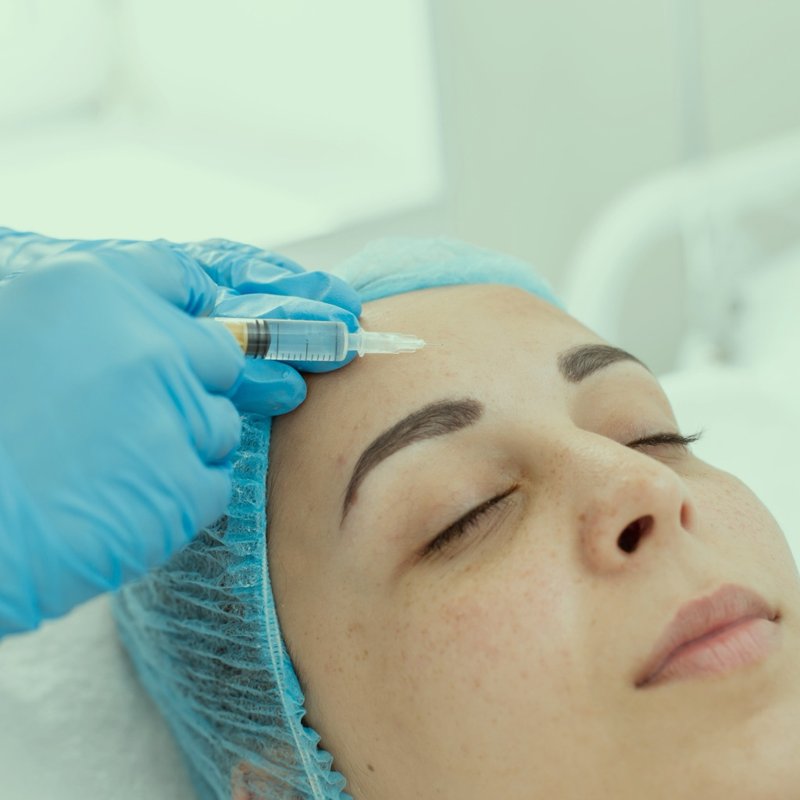 Mesoterapia facial para revitalizar la piel del rostro, un procedimiento de la Dra. Lola Lopera en Cádiz.